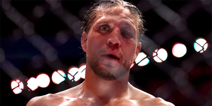 Pertarungan UFC 306 Brian Ortega dan Diego Lope Mengakibatkan Brian Ortega, Mengalami Luka Yang Mengerikan